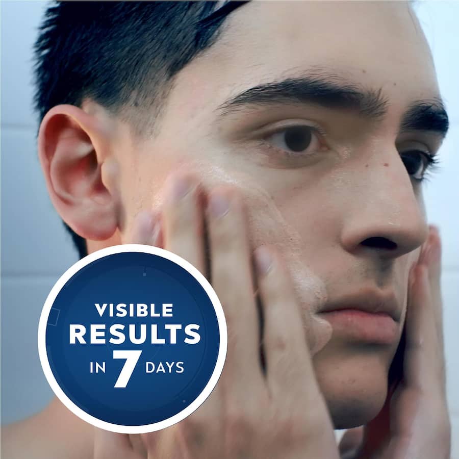 Nivea Men Acne Clear Face Wash Deep Rapid 150mL