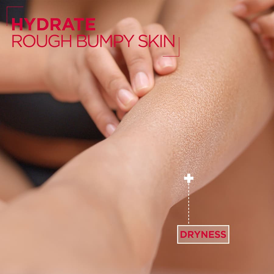 Mixa Body Lotion Urea Cica Repair+ 250mL