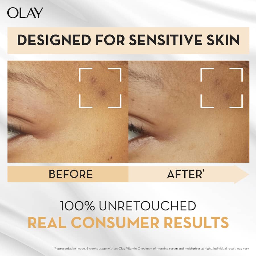 Olay Luminous Face Serum Vitamin C Sensitive 30mL