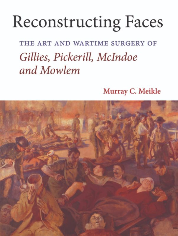 A hardback book titled 'Reconstructing Faces' detailing advancements in plastic surgery and key WWII pioneers.