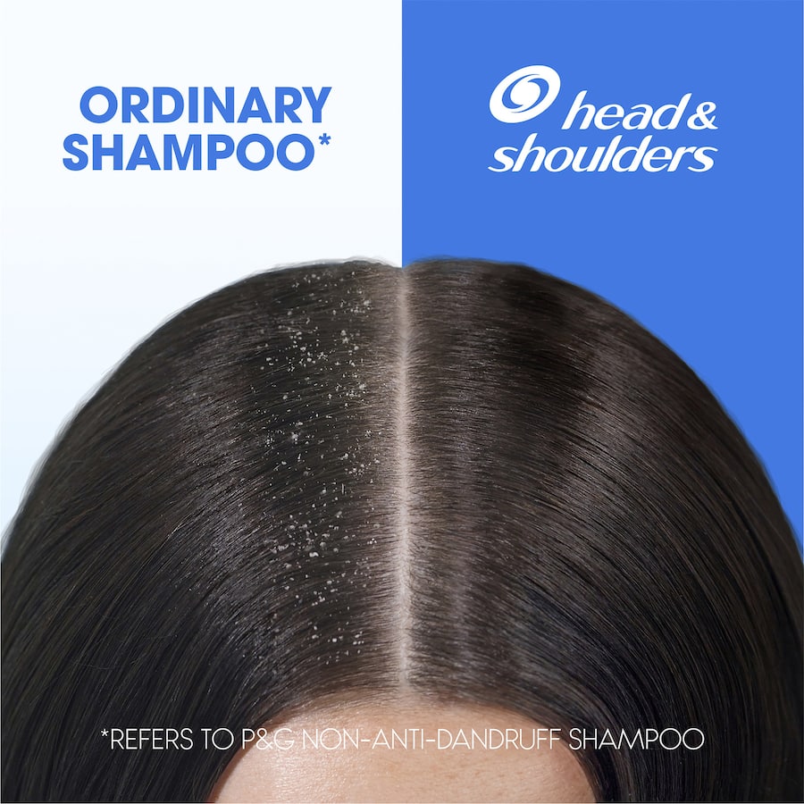 Head & Shoulders 2 In 1 Shampoo & Conditioner Apple Fresh 350mL