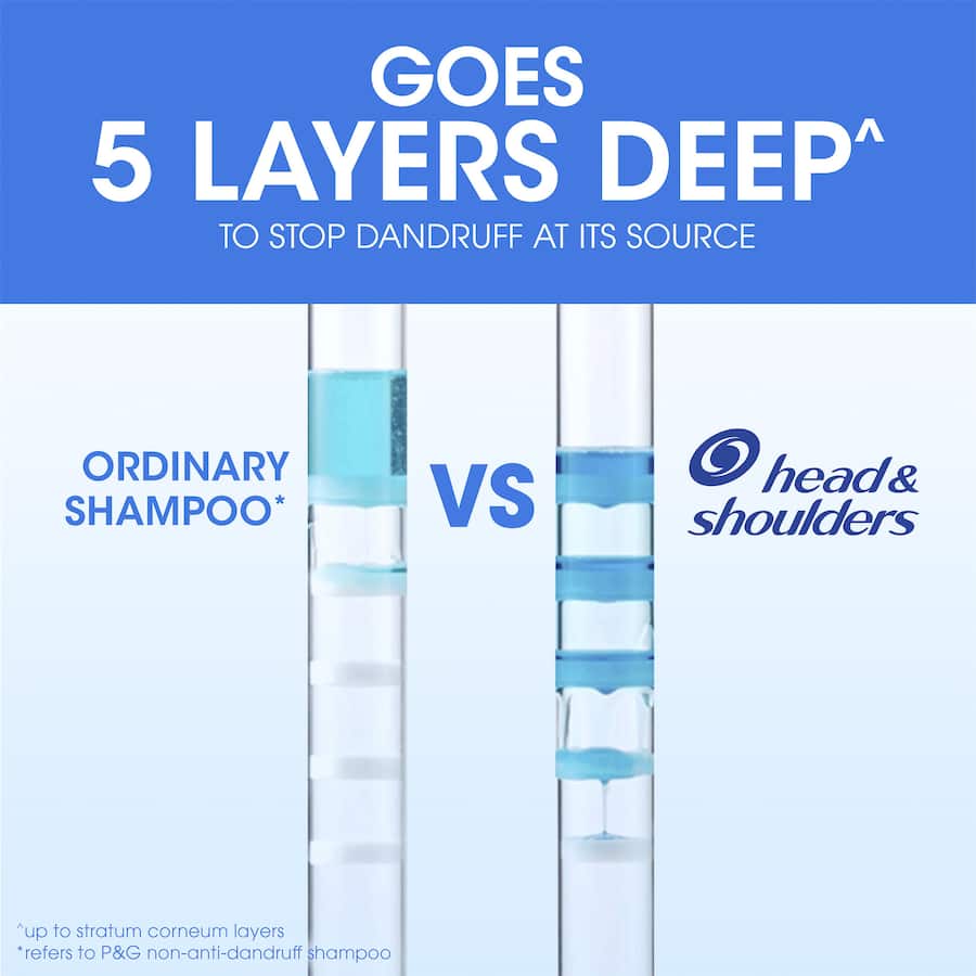 Head & Shoulders 2 In 1 Shampoo & Conditioner Itchy Scalp Care 750mL